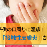 子供の口周りに赤い湿疹(ブツブツ)